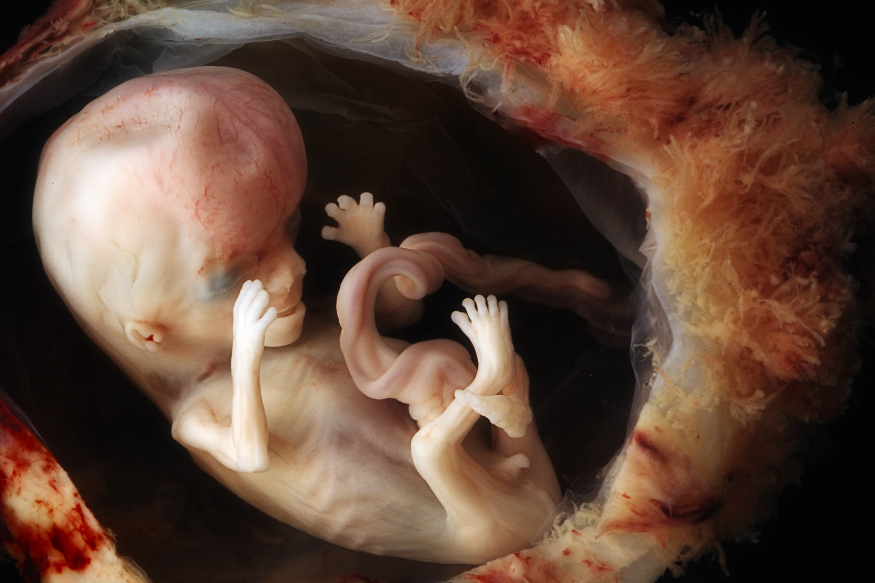 fetus