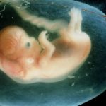 fetus_10w