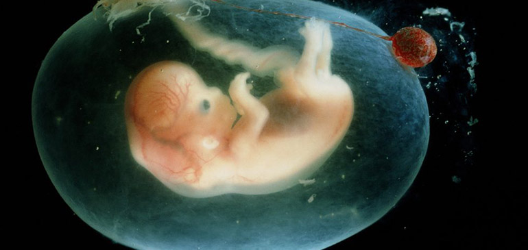 fetus_10w