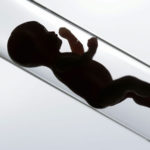 IVF test tube baby