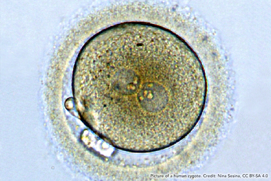 Picture of a human zygote. Credit: Nina Sesina, CC BY-SA 4.0