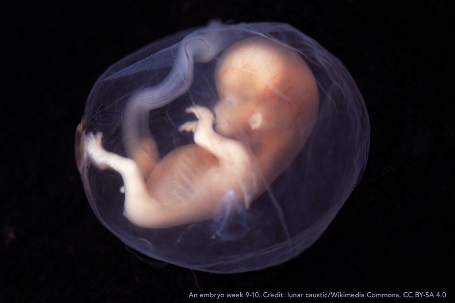 An embryo week 9-10. Credit: lunar caustic/Wikimedia Commons, CC BY-SA 4.0